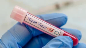 nipah-outbreak-risk-in-pakistan-remains-low-nih