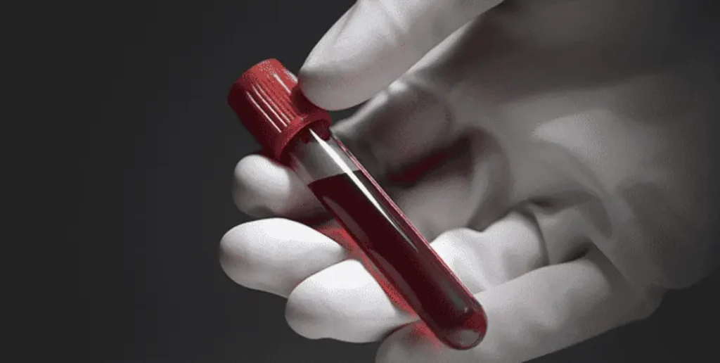 gulf-country-introduces-premarital-medical-tests-for-all-couples