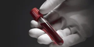 gulf-country-introduces-premarital-medical-tests-for-all-couples