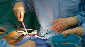 kidney-transplant-services-to-begin-in-rawalpindi-by-march-end