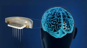 china-approves-first-market-ready-brain-implant-to-cure-paralysis-neck-injuries