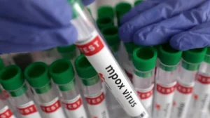 kp-hospitals-put-on-high-alert-as-mpox-cases-increase