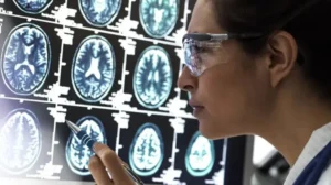 memory-loss-in-alzheimers-and-dopamine-have-a-strong-link-new-study-finds