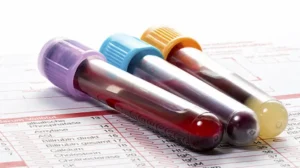 health-experts-want-govt-to-make-pre-marital-blood-test-mandatory-for-nikkah