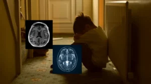 pakistani-children-living-in-violent-homes-may-suffer-brain-damage-like-soldiers
