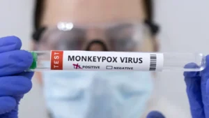 another-suspected-mpox-case-reported-at-major-hospital-in-punjab