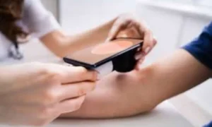 pakistani-doctor-develops-ai-chatbot-for-skin-cancer-awareness