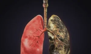 new-drug-reduces-death-risk-among-lung-cancer-patients-by-30