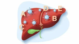 pakistan-ranks-5th-in-hepatitis-cases-globally