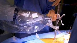 pakistan-performs-first-ever-semi-active-robotic-spine-surgery