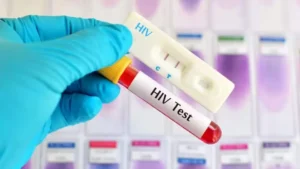 hiv-has-killed-more-than-25000-people-in-pakistan-since-1987